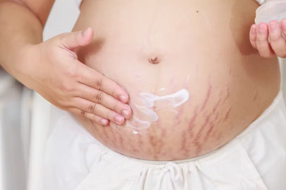 MamaGlow Balm